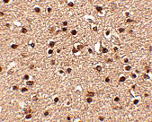 2 - Dact2 Antibody ASC10789