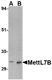 1 - MettL7B Antibody ASC10796