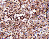 2 - MettL7B Antibody ASC10801