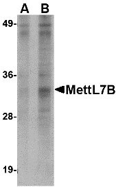 1 - MettL7B Antibody ASC10801