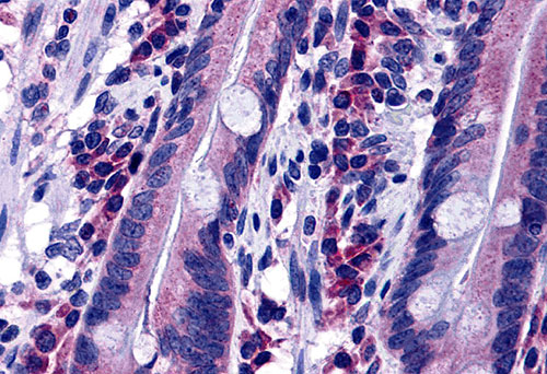 2 - DISP2 Antibody ASC10802