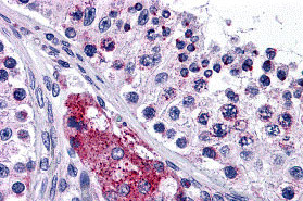 2 - PTCHD2 Antibody ASC10803