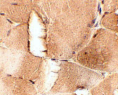 2 - JPH1 Antibody ASC10804