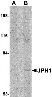 1 - JPH1 Antibody ASC10804