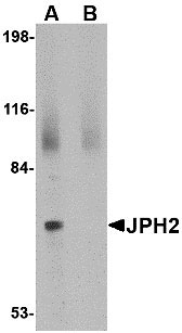 1 - JPH2 Antibody ASC10805
