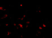 3 - JPH3 Antibody ASC10806