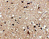 2 - JPH3 Antibody ASC10806