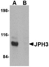 1 - JPH3 Antibody ASC10806
