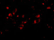 3 - JPH4 Antibody ASC10807