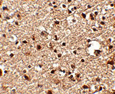 2 - JPH4 Antibody ASC10807