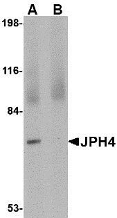 1 - JPH4 Antibody ASC10807