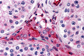 2 - PTCHD2 Antibody ASC10808