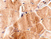 2 - JPH2 Antibody ASC10809