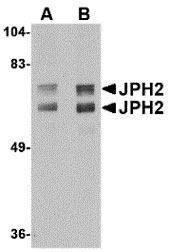 1 - JPH2 Antibody ASC10809
