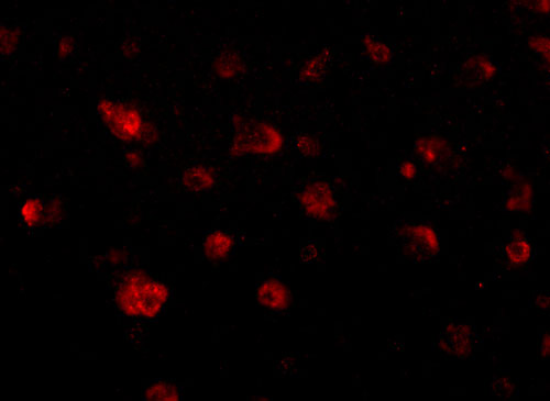 3 - JPH3 Antibody ASC10810