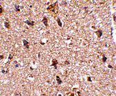 2 - JPH3 Antibody ASC10810