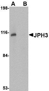 1 - JPH3 Antibody ASC10810