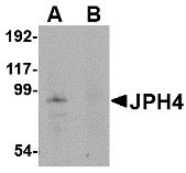 1 - JPH4 Antibody ASC10811