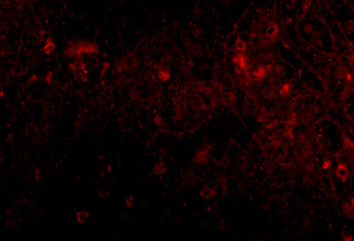 3 - PIG-Y Antibody ASC10815