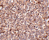 2 - PIG-Y Antibody ASC10815