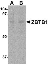 1 - ZBTB1 Antibody ASC10818