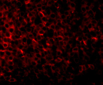 3 - PIG-Y Antibody ASC10820