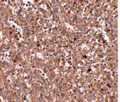 2 - PIG-Y Antibody ASC10820