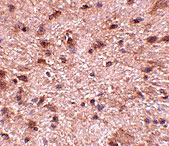 2 - NIPSNAP3B Antibody ASC10821