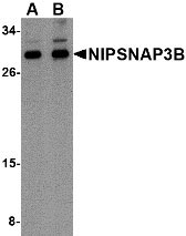 1 - NIPSNAP3B Antibody ASC10821