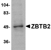 1 - ZBTB2 Antibody ASC10823