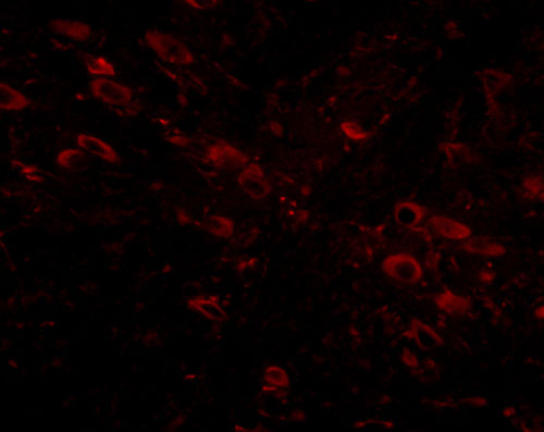3 - Gle1 Antibody ASC10824