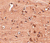 2 - Gle1 Antibody ASC10824