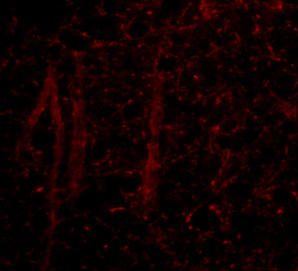 3 - Gle1 Antibody ASC10828