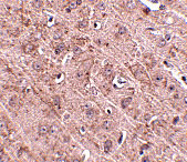 2 - Gle1 Antibody ASC10828