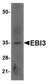 1 - EBI3 Antibody ASC10829