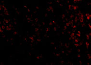 3 - KLRA1 Antibody ASC10834