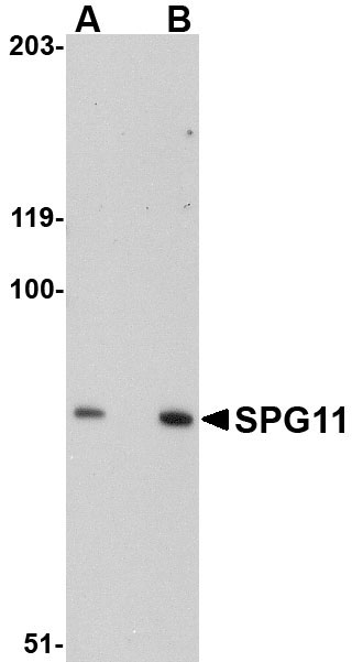 1 - SPG11 Antibody ASC10847