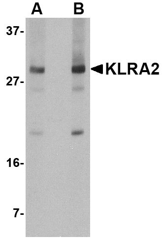 1 - KLRA2 Antibody ASC10848