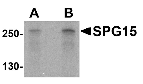 1 - SPG15 Antibody ASC10851