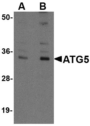 1 - ATG5 Antibody ASC10852