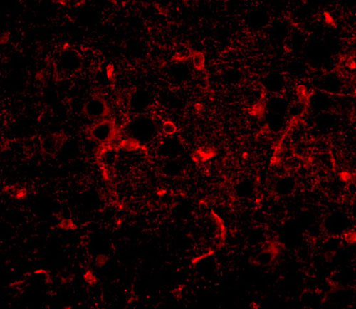 3 - CDIP Antibody ASC10855