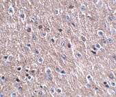 2 - CDIP Antibody ASC10855
