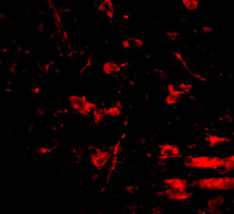 3 - RCAN2 Antibody ASC10857