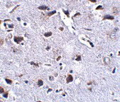 2 - RCAN2 Antibody ASC10857