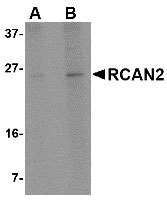 1 - RCAN2 Antibody ASC10857