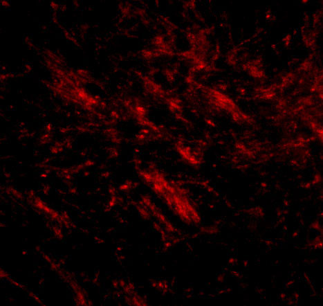 3 - CDIP Antibody ASC10859