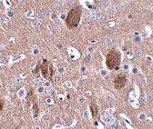2 - CDIP Antibody ASC10859