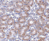 2 - MTCH2 Antibody ASC10861