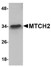 1 - MTCH2 Antibody ASC10861