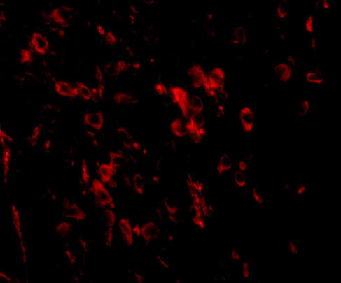 3 - LRFN1 Antibody ASC10862